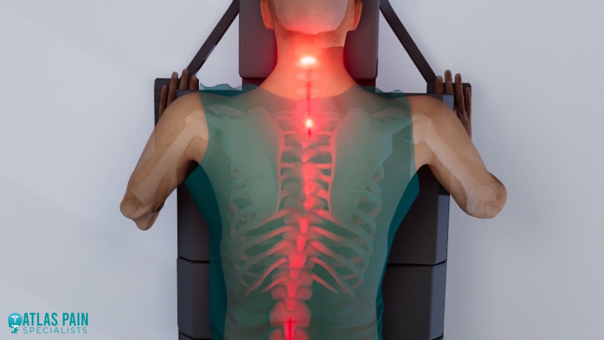 A misaligned spine for Neck Pain Worse After ChiropractorÂ 